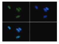 H3R17me2(asym) | Histone H3 (asym-dimethyl Arg17) in the group Antibodies Plant/Algal / DNA/RNA/Cell Cycle / Epigenetics/DNA methylation at Agrisera AB (Antibodies for research) (AS16 3180)
